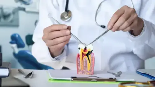 What is the Average Cost of a Root Canal Treatment?